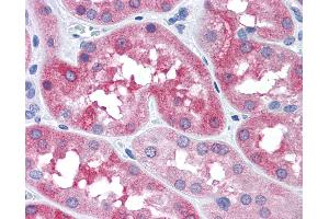 Anti-MAPT / Tau antibody IHC of human kidney.