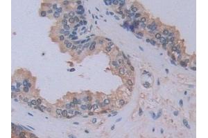 Detection of PEBP1 in Human Prostate Tissue using Polyclonal Antibody to Phosphatidylethanolamine Binding Protein 1 (PEBP1) (PEBP1 anticorps  (AA 2-187))