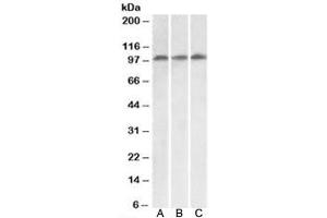 Western blot testing of HeLa [A], HepG2 [B] and Jurkat [C] lysates with VPS16 antibody at 0. (VPS16 anticorps  (Isoform 1))