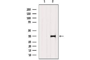 Western blot analysis of extracts from 3t3, using SULT2A1 Antibody.