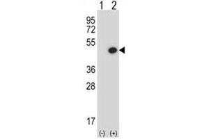 Western blot analysis of BMP7 antibody and 293 cell lysate either nontransfected (Lane 1) or transiently transfected (2) with the BMP7 gene.
