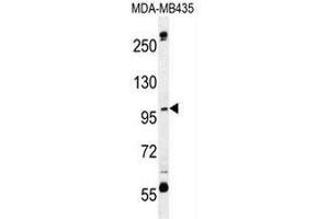 CA026 Antibody (N-term) western blot analysis in MDA-MB435 cell line lysates (35µg/lane). (SWT1 anticorps  (N-Term))