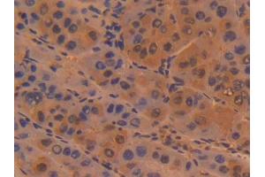 DAB staining on IHC-P; Samples: Human Liver Tissue (Sialoadhesin/CD169 anticorps  (AA 34-240))