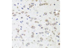 Immunohistochemistry of paraffin-embedded mouse brain using IGFBP5 antibody (ABIN6292146) at dilution of 1:100 (40x lens). (IGFBP5 anticorps)