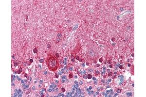 Anti-KCNMA1 antibody IHC of human brain, cerebellum.