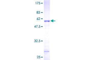 Image no. 1 for Proteasome (Prosome, Macropain) Subunit, beta Type 10 (PSMB10) (AA 1-273) protein (GST tag) (ABIN1316571)