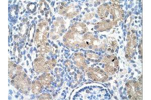 Image no. 1 for anti-Uroporphyrinogen Decarboxylase (UROD) (AA 101-150) antibody (ABIN203398)