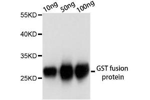 Western blot analysis of over-expressed GST fusion protein using GST-tag antibody. (GST anticorps)