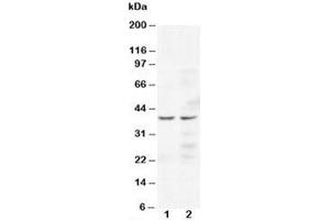 Western blot testing of CCR5 antibody and Lane 1:  Jurkat;  2: COLO320 cell lysate (CCR5 anticorps  (N-Term))