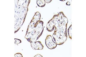 Immunohistochemistry of paraffin-embedded human placenta using PSAP Rabbit pAb (ABIN3022605, ABIN3022606, ABIN3022607, ABIN1513432 and ABIN6218938) at dilution of 1:50 (40x lens).