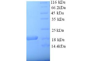 SDS-PAGE (SDS) image for alpha-2-Macroglobulin (A2M) (AA 620-750), (partial) protein (His tag) (ABIN5713188)