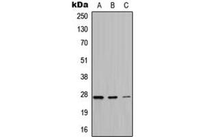Western blot analysis of ATP6 expression in HeLa (A), A549 (B), PC12 (C) whole cell lysates. (MT-ATP6 anticorps  (Center))