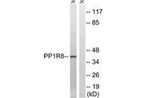 Western blot analysis of extracts from Jurkat cells, using PPP1R8 Antibody. (PPP1R8 anticorps  (AA 196-245))