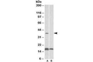 Western blot testing of human frontal cortex lysate with CD57 antibody at 0. (CD57 anticorps)