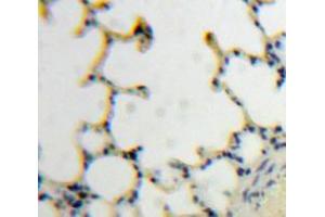 IHC-P analysis of Lung tissue, with DAB staining. (TLR7 anticorps  (AA 890-1037))