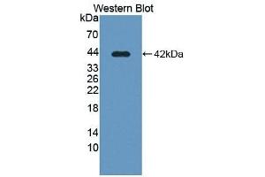Detection of Recombinant SLC39A6, Human using Polyclonal Antibody to Solute Carrier Family 39, Member 6 (SLC39A6) (SLC39A6 anticorps  (AA 29-325))