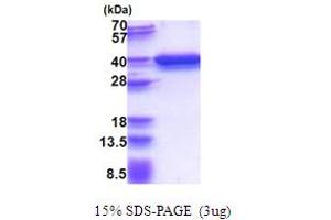 SDS-PAGE (SDS) image for Regulation of Nuclear Pre-mRNA Domain Containing 1A (RPRD1A) (AA 1-312) protein (His tag) (ABIN5853662) (RPRD1A Protein (AA 1-312) (His tag))