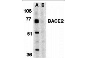 Western Blotting (WB) image for anti-beta-Site APP-Cleaving Enzyme 2 (BACE2) (C-Term) antibody (ABIN1030277) (BACE2 anticorps  (C-Term))