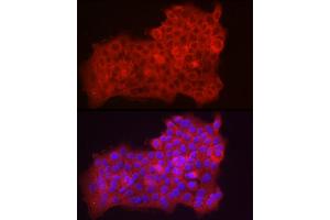 Immunofluorescence analysis of  cells using Fbx32/FBOX32 Rabbit pAb (ABIN3017561, ABIN3017562, ABIN3017563, ABIN1679825 and ABIN6220155) at dilution of 1:50 (40x lens). (FBXO32 anticorps  (AA 206-355))