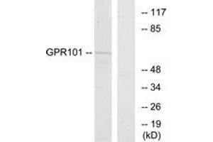 Western blot analysis of extracts from COS7 cells, using GPR101 Antibody. (GPR101 anticorps  (AA 451-500))