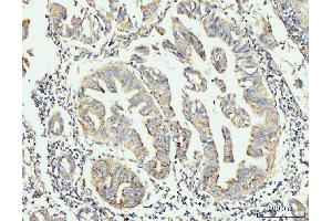 IHC analysis of GRPEL1 using anti-GRPEL1 antibody (ABIN7602643). (GRPEL1 anticorps  (AA 90-217))