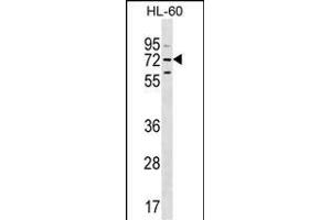 MBTD1 Antibody (C-term) (ABIN655319 and ABIN2844896) western blot analysis in HL-60 cell line lysates (35 μg/lane). (MBTD1 anticorps  (C-Term))