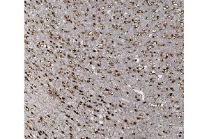 IHC analysis of FOXP1 using anti-FOXP1 antibody (ABIN7602780). (FOXP1 anticorps  (C-Term))