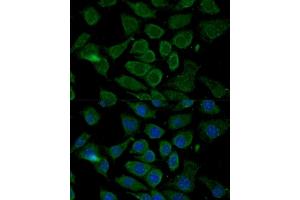 Immunofluorescence analysis of L929 cells using Bcl-2 antibody (ABIN3016825, ABIN3016826, ABIN3016827 and ABIN6219850) at dilution of 1:100. (Bcl-2 anticorps  (AA 81-131))