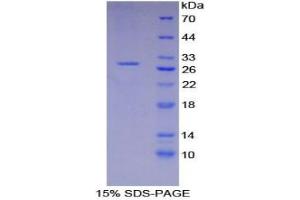 SDS-PAGE analysis of Mouse XRCC6 Protein. (XRCC6 Protéine)