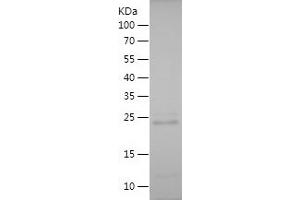 Western Blotting (WB) image for Yes-Associated Protein 1 (YAP1) (AA 350-504) protein (His tag) (ABIN7125757)