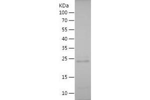 Western Blotting (WB) image for Yes-Associated Protein 1 (YAP1) (AA 350-504) protein (His tag) (ABIN7125757) (YAP1 Protein (AA 350-504) (His tag))