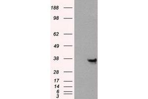 Western Blotting (WB) image for anti-Annexin A10 (ANXA10) antibody (ABIN1496651)