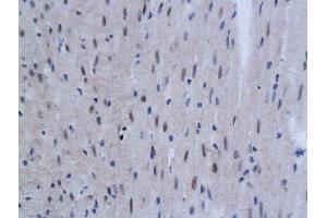 Formalin-fixed and paraffin embedded mouse myocardial tissue labeled with Anti SnoN Polyclonal Antibody, Unconjugated  followed by conjugation to the secondary antibody and DAB staining (SKIL anticorps  (AA 301-400))