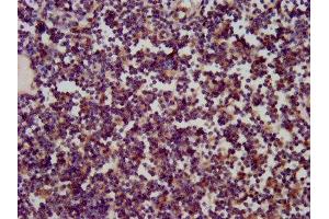 IHC image of ABIN7170587 diluted at 1:200 and staining in paraffin-embedded human lymph node tissue performed on a Leica BondTM system. (SKA1 anticorps  (AA 61-134))