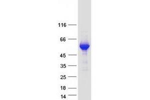 Validation with Western Blot