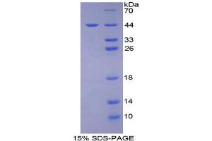 SDS-PAGE analysis of Human CD2 Associated Protein. (CD2AP Protéine)