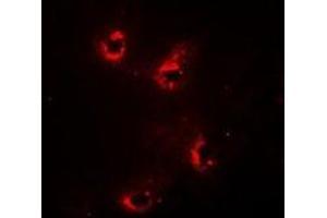 Immunofluorescent analysis of Alpha-crystallin A staining in Hela cells.