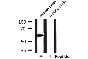 Western blot analysis of extracts from mouse brain, using HNRPLL Antibody. (HNRPLL anticorps  (Internal Region))