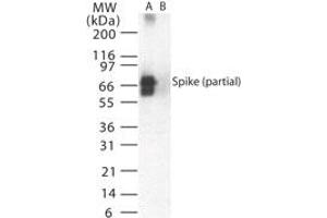 Image no. 1 for anti-SARS-Coronavirus Spike Protein (SARS-CoV S) (AA 19-35) antibody (ABIN199980) (SARS-CoV Spike anticorps  (AA 19-35))