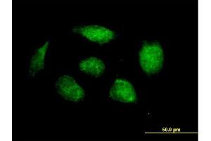 Immunofluorescence of purified MaxPab antibody to HOXB1 on HeLa cell.