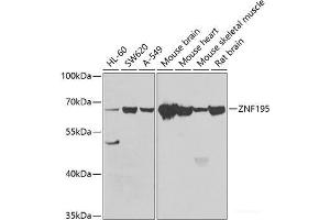 Western blot analysis of extracts of various cell lines using ZNF195 Polyclonal Antibody at dilution of 1:1000. (ZNF195 anticorps)