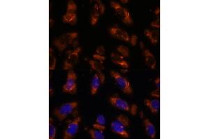 Immunofluorescence analysis of U-2 OS cells using PDE6G antibody (ABIN7269304) at dilution of 1:100.