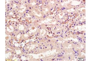 Formalin-fixed and paraffin embedded rat kidney labeled with Rabbit Anti OSTM1 Polyclonal Antibody, Unconjugated (ABIN1387308) at 1:200 followed by conjugation to the secondary antibody and DAB staining (OSTM1 anticorps  (AA 21-120))