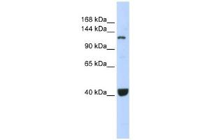 PIWIL1 antibody used at 1 ug/ml to detect target protein. (PIWIL1 anticorps)