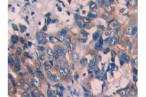 Used in DAB staining on fromalin fixed paraffin- embedded kidney tissue
