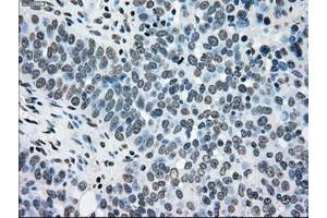 Image no. 7 for anti-TYRO3 Protein Tyrosine Kinase (TYRO3) antibody (ABIN1501607)