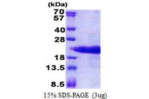 SDS-PAGE (SDS) image for Prothymosin, alpha (PTMA) (AA 1-110) protein (His tag) (ABIN5853228)