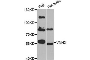 Western blot analysis of extracts of Raji and rat testis cell lines, using VNN2 antibody. (VNN2 anticorps)