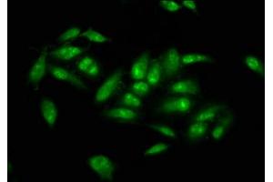 Immunofluorescence staining of Hela cells with ABIN7173496 at 1:66, counter-stained with DAPI.