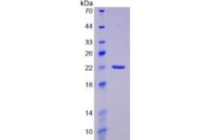 SDS-PAGE of Protein Standard from the Kit (Highly purified E.